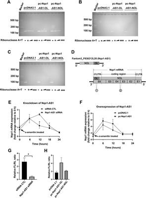 LncRNA Nqo1-AS1 Attenuates Cigarette Smoke-Induced Oxidative Stress by Upregulating its Natural Antisense Transcript Nqo1